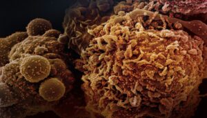 Cancer Prevention & Chronic Illness